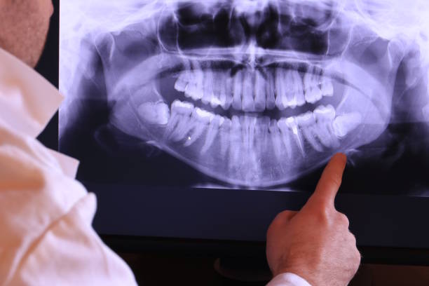 Best Tooth Infection Emergency Dentist  in International Falls, MN