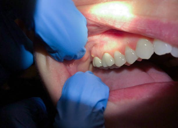 Best Urgent Tooth Repair  in International Falls, MN