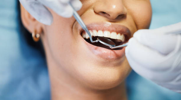 Best Chipped Tooth Repair Near Me  in International Falls, MN