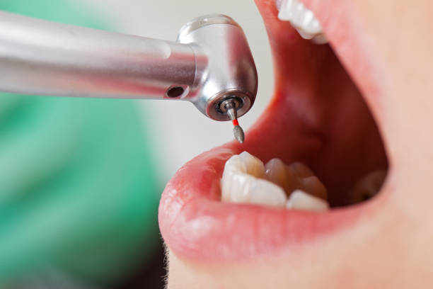 Best Tooth Infection Emergency Dentist  in International Falls, MN